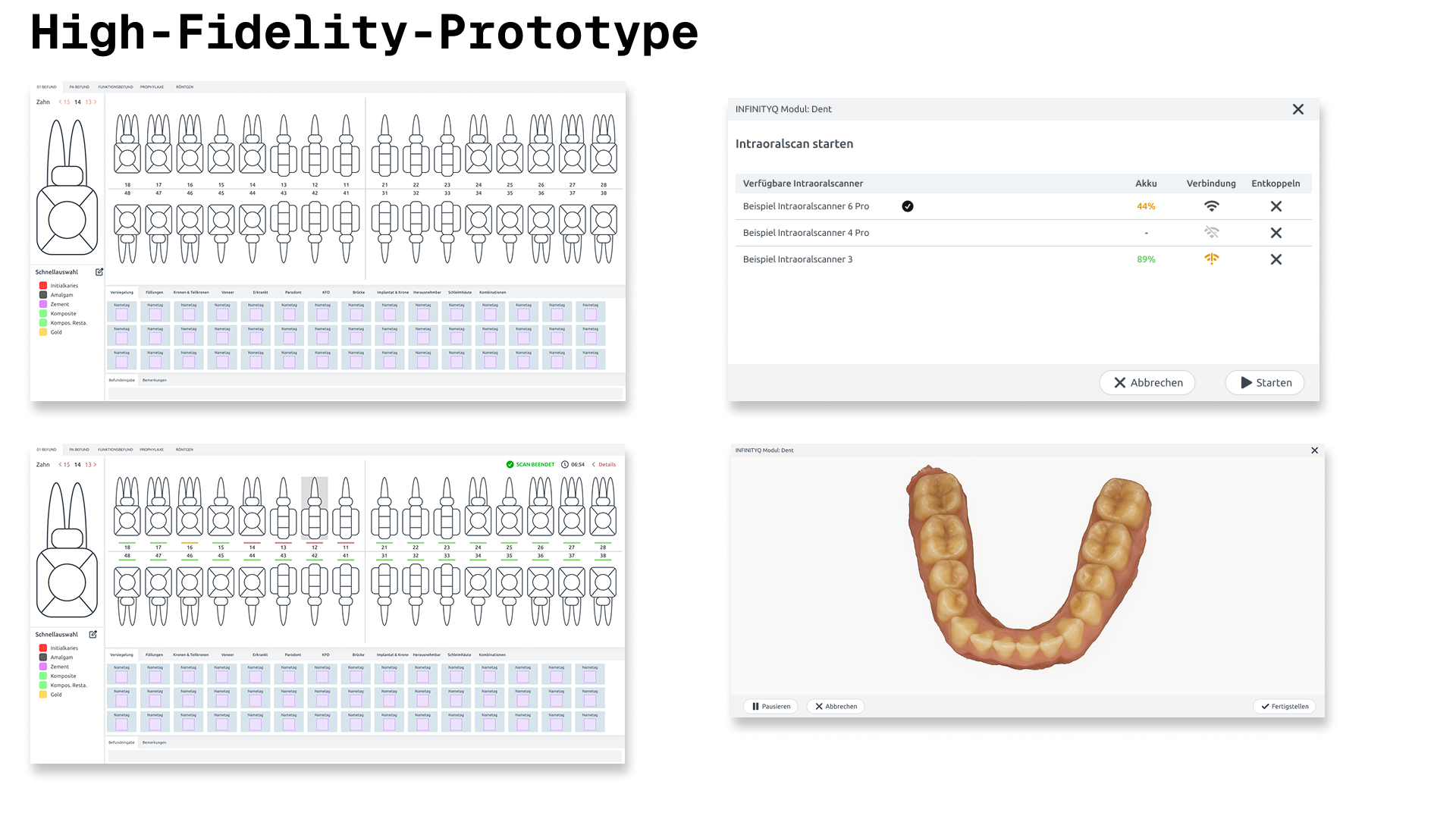 Concept: Digitalized Dental Examination 2